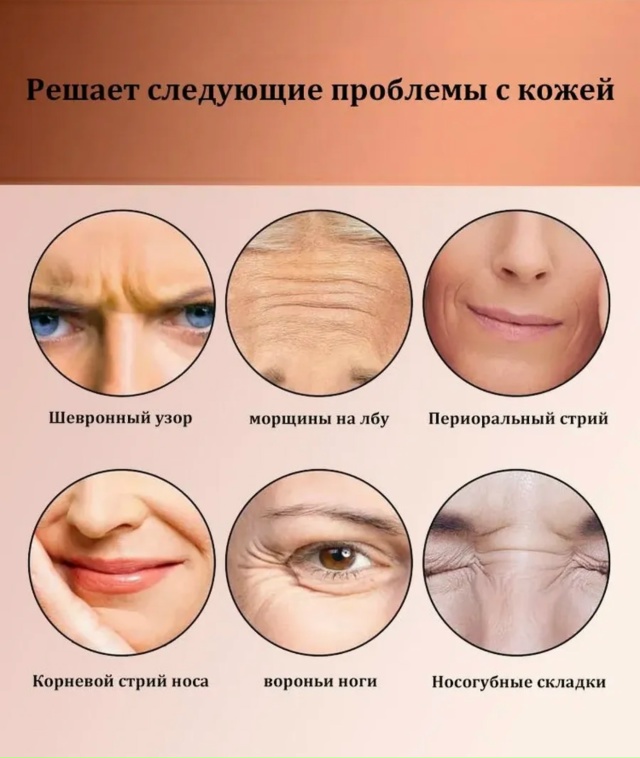 Крем для удаления веснушек 23080139