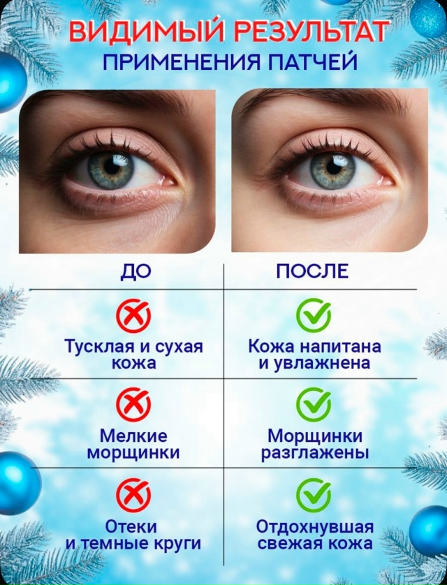 Патчи для вокруг глаз 23154844